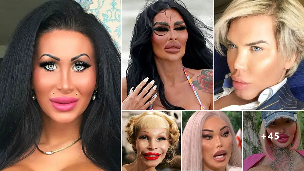 People Who Took Plastic Surgery Too Far