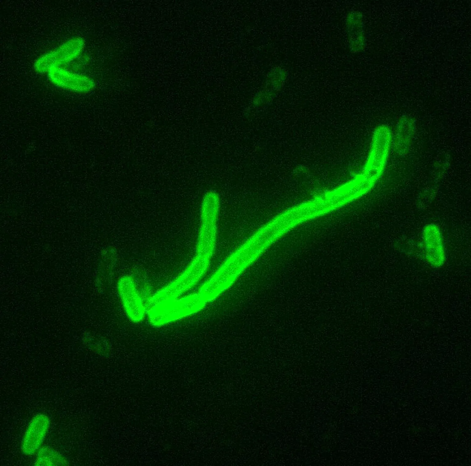 What Is Pneumonic Plague? Symptoms, Treatment and Prevention