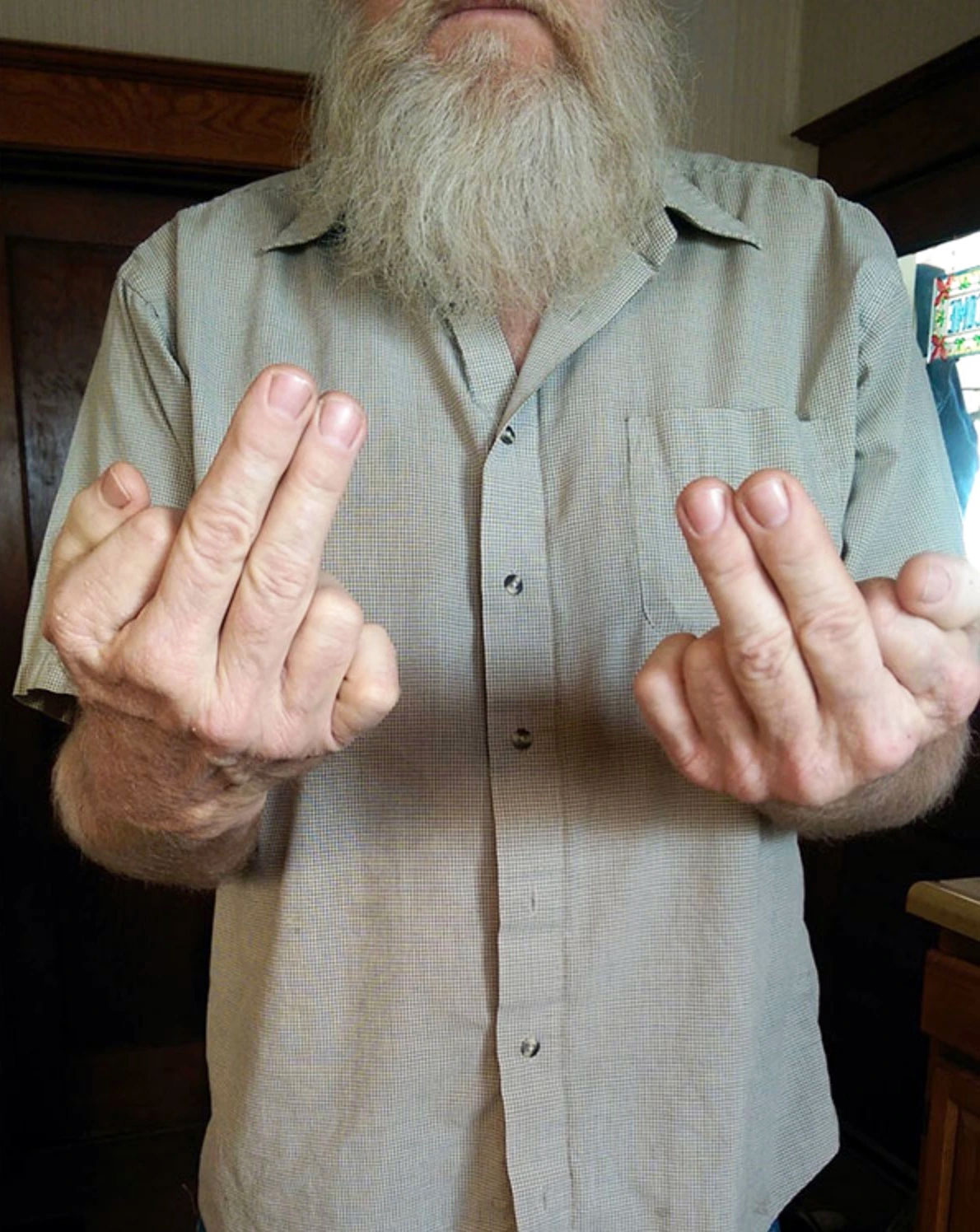 6 Fingers On Each Hand