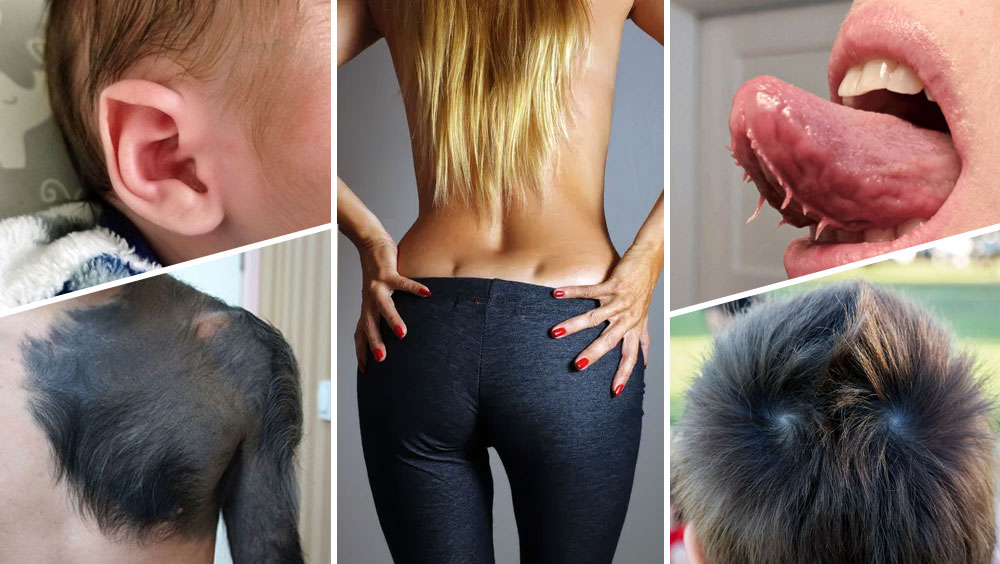 People Share Their One-of-a-Kind Body Features