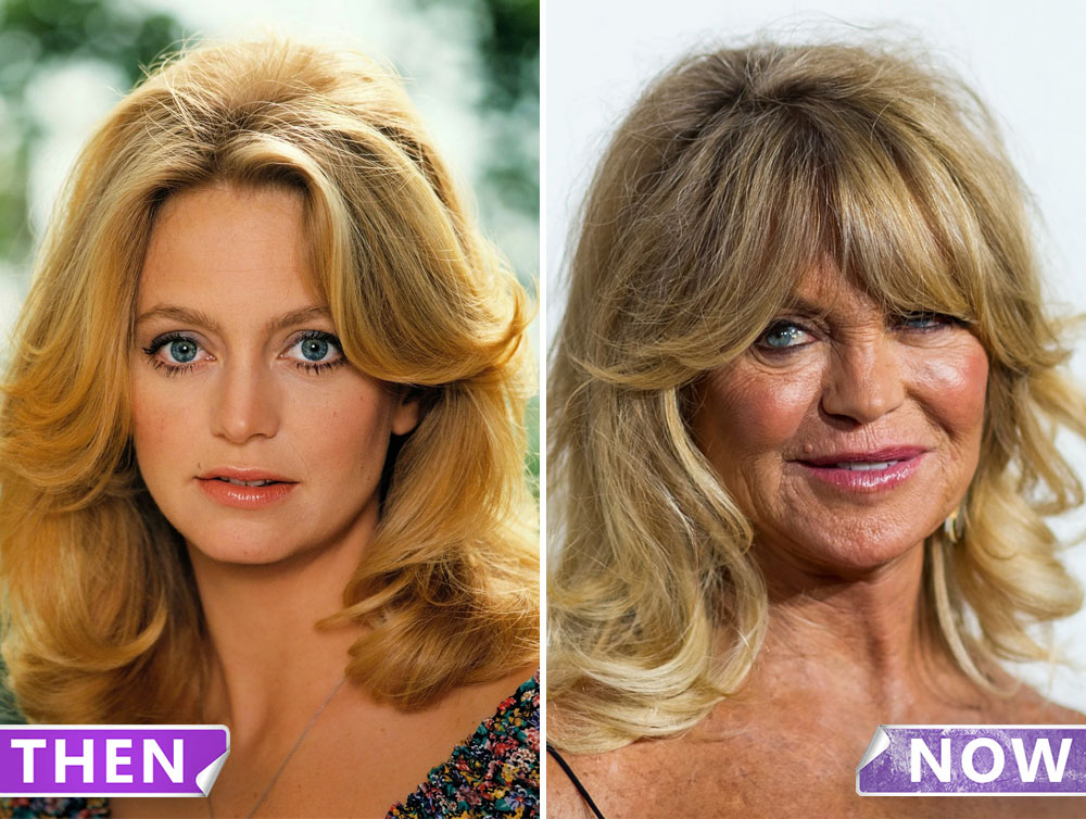 Goldie Hawn