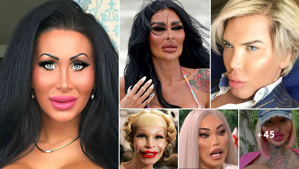 People Who Took Plastic Surgery Too Far
