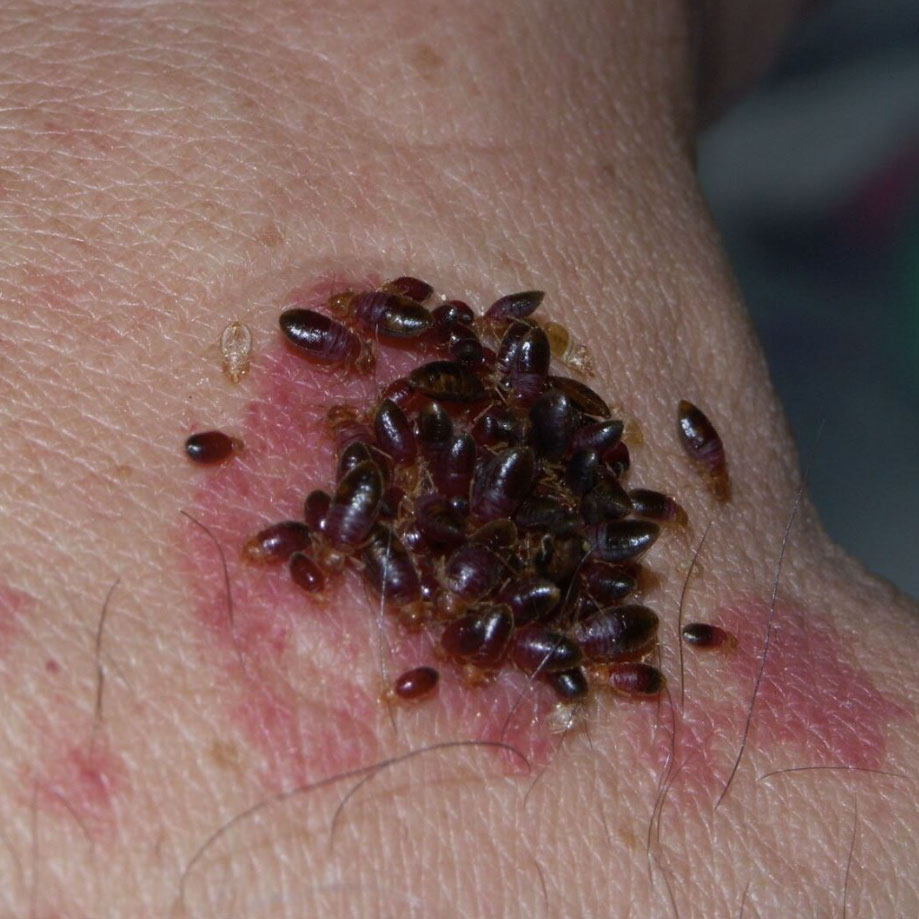 how to check for bed bugs_5d9ef95b 25ff 4ae7 9f44 a3f9d5e96374