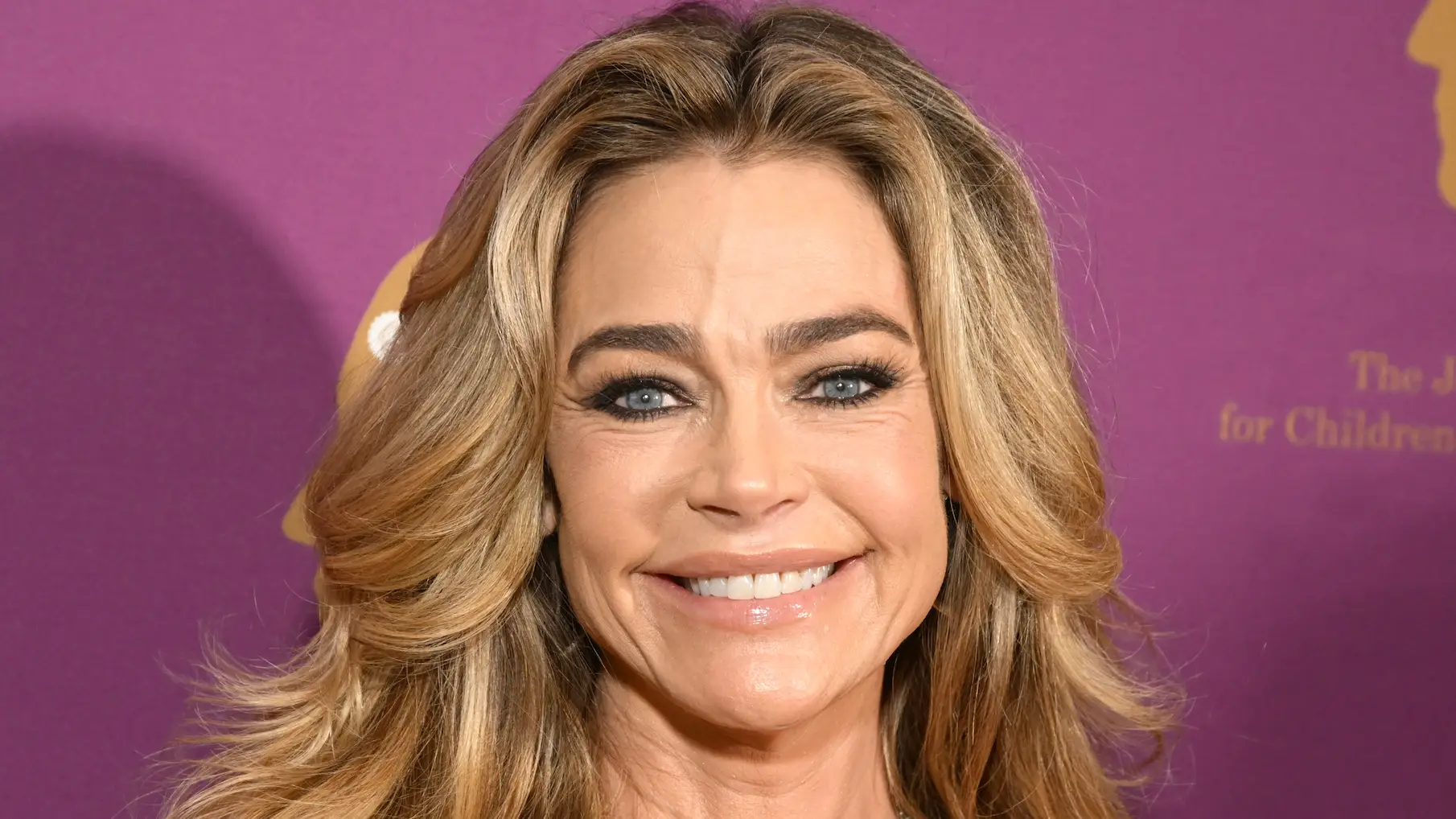 How Facelifts Work: Understanding the Procedure Behind Denise Richards' Transformation