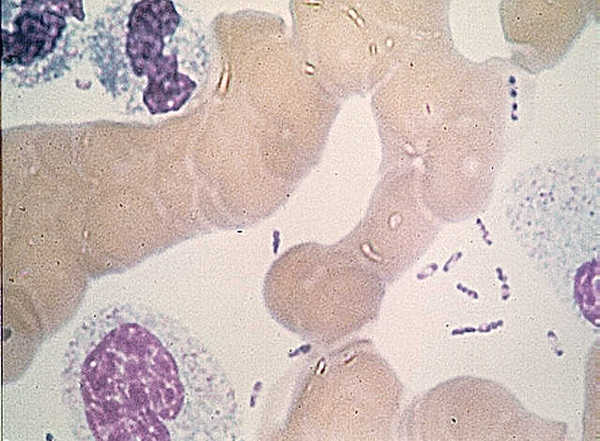 1791211812367_Yersinia_pestis_wayson